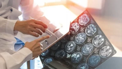 دراسة:-بروتين-يقلل-خطر-إصابة-الناجين-من-السرطان-بالخرف