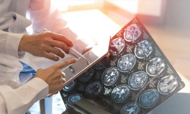 دراسة:-بروتين-يقلل-خطر-إصابة-الناجين-من-السرطان-بالخرف