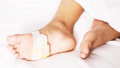 تطوير-‘جل’-لمرضى-السكري-يمنع-بتر-الأطراف