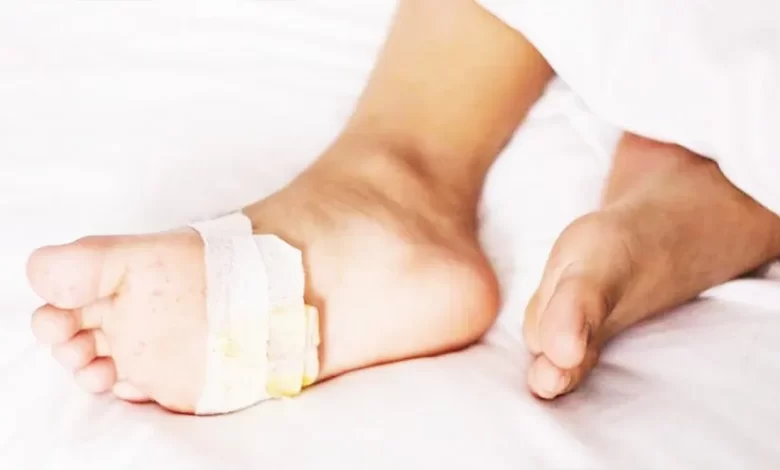 تطوير-‘جل’-لمرضى-السكري-يمنع-بتر-الأطراف