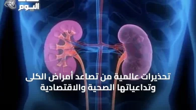 تحذيرات-عالمية-من-تصاعد-أمراض-الكلى-وتداعياتها-الصحية-والاقتصادية