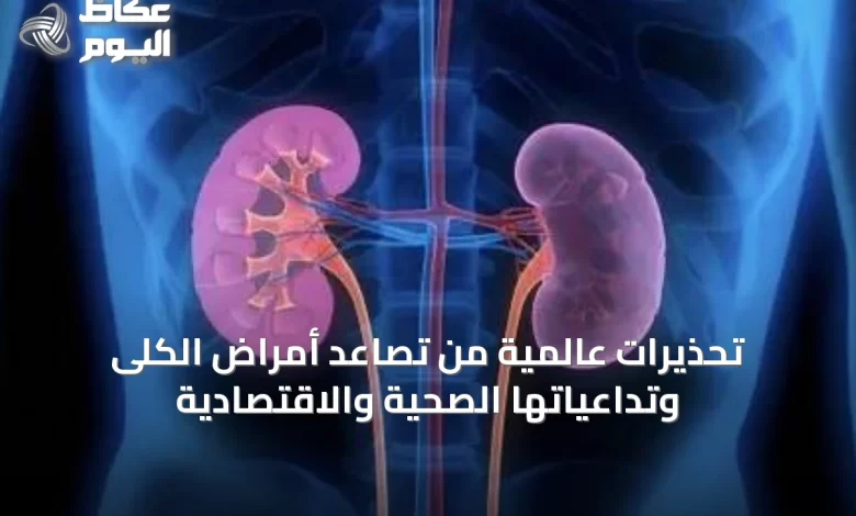 تحذيرات-عالمية-من-تصاعد-أمراض-الكلى-وتداعياتها-الصحية-والاقتصادية