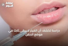 دراسة-تكشف-أن-الفيلر-لا-يبقى-ثابتًا-في-موضع-الحقن