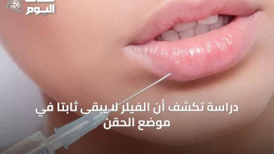 دراسة-تكشف-أن-الفيلر-لا-يبقى-ثابتًا-في-موضع-الحقن