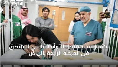 اكتمال-عملية-فصل-التوأم-الفلبيني-الملتصق-في-المرحلة-الرابعة-بالرياض