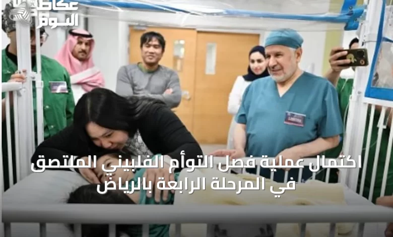 اكتمال-عملية-فصل-التوأم-الفلبيني-الملتصق-في-المرحلة-الرابعة-بالرياض