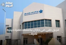 فريق-طبي-في-جازان-يكتشف-طفرة-جينية-نادرة-مصاحبة-لمرض-هاشيموتو